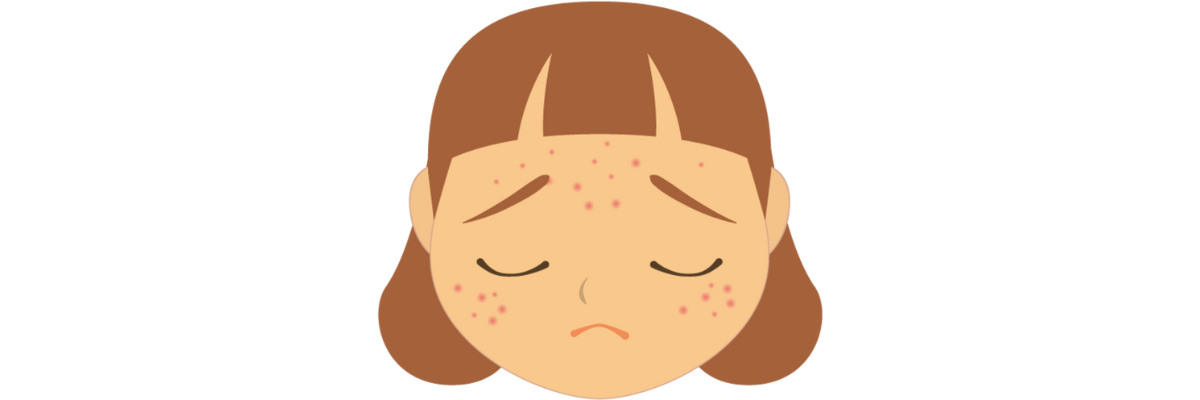 Acne and Insecurities